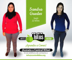 20_Sandra-Guedes-Frente-FB_001antes-despues