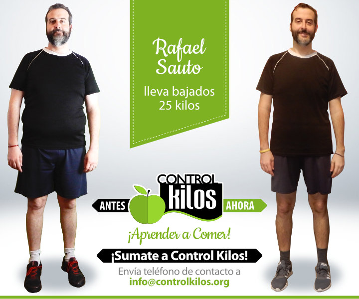 Antes-Despues