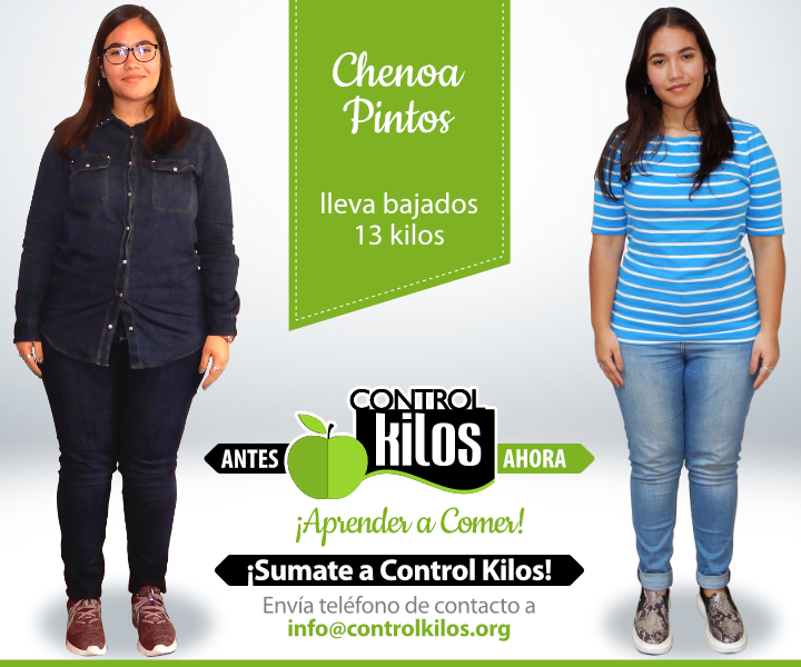 Antes-Despues