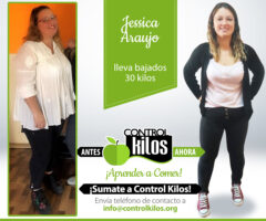 Antes-Despues