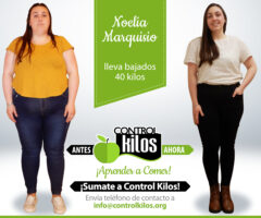 Antes-Despues