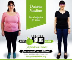 Antes-Despues