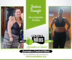 Antes-Despues