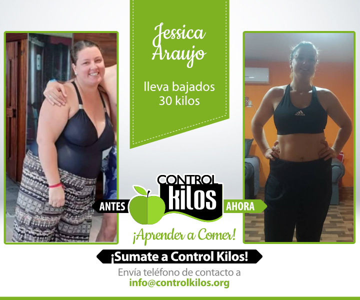 Antes-Despues
