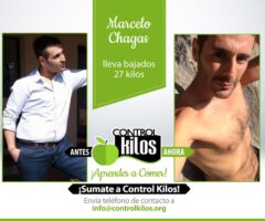 Antes-Despues