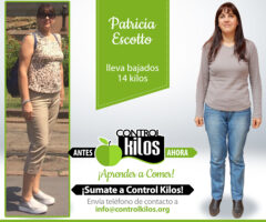 Antes-Despues