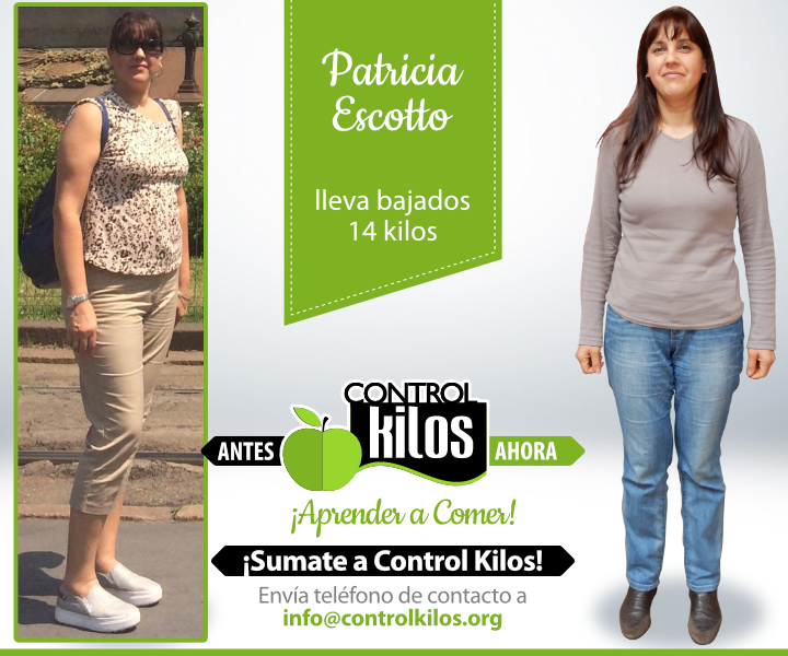 Antes-Despues