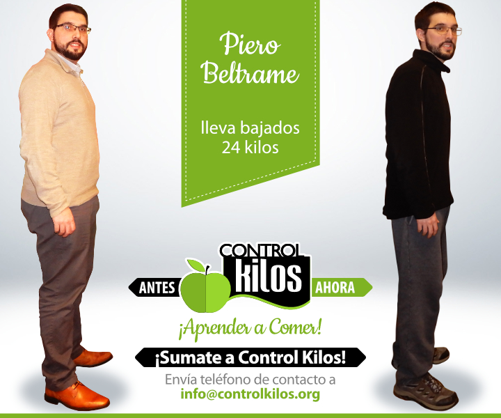 Antes-Despues