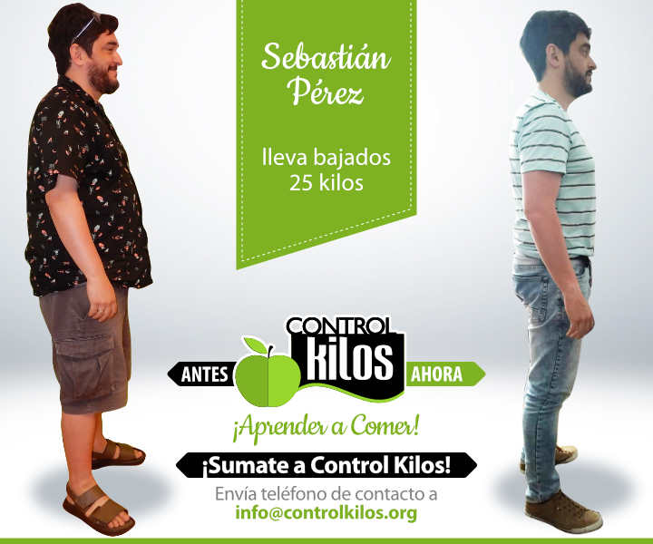 Antes-Despues