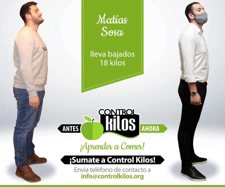 Antes-Despues
