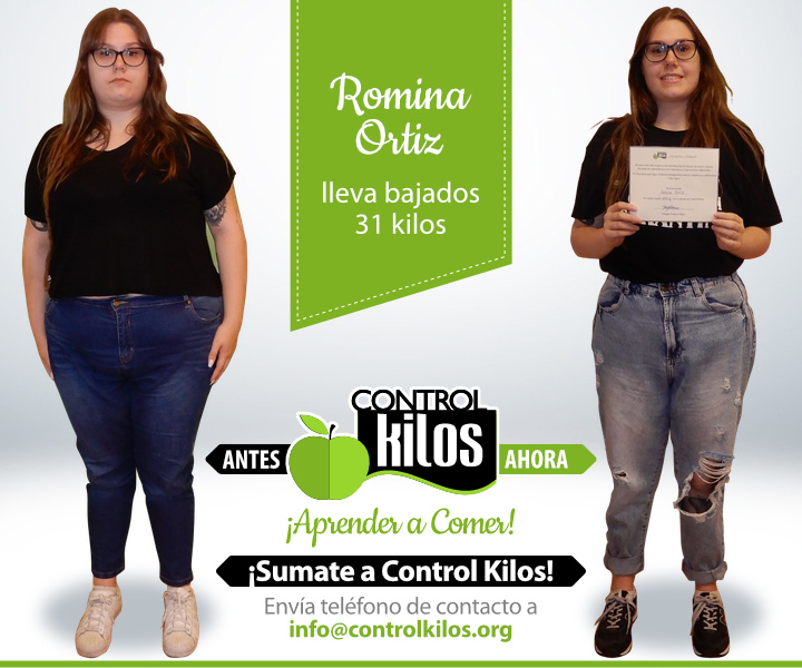 Antes-Despues