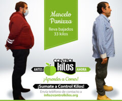 Antes-Despues