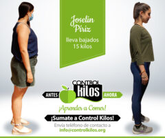 Antes-Despues