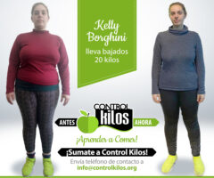 Antes-Despues