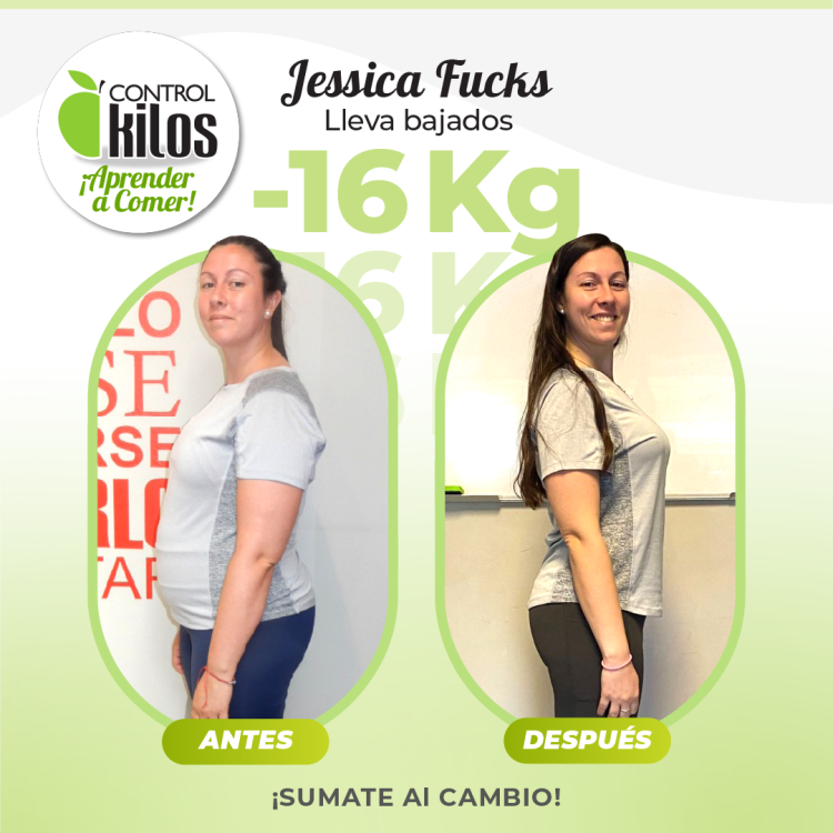 Antes y despues post