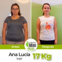 Antes y despues Ana lucia post