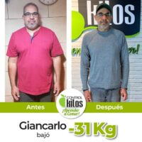 Antes y Despues Giancarlo post