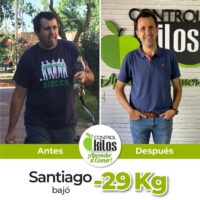 Antes y Despues Santiago post