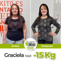 Antes y despues Graciela post 1