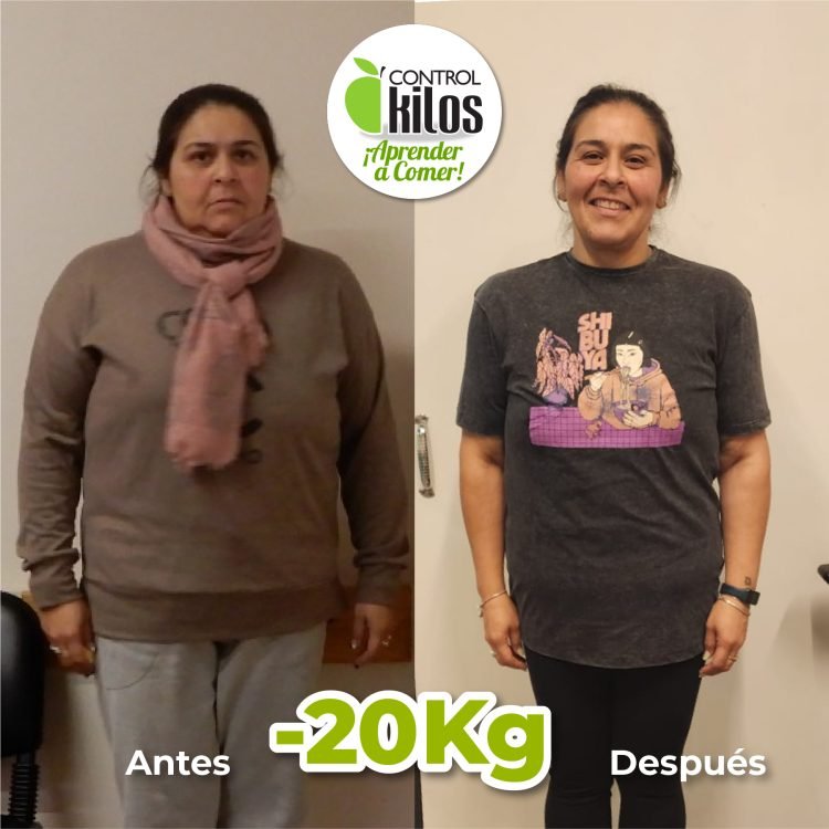 Antes y Despues Daniela Millan post 1