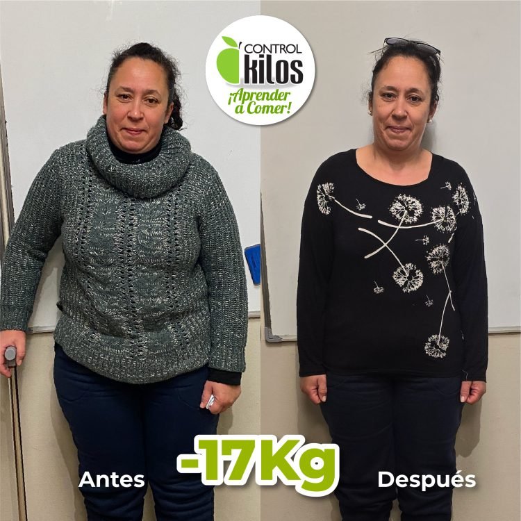 Antes y despues Erika Almada post 1